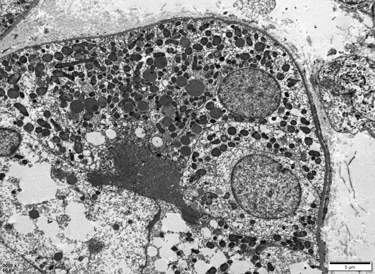 4ab0b167d549ebc66df33f1cace8092d