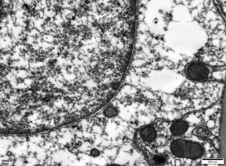 53a548f135f3846ba5f65a2e2dc408b8