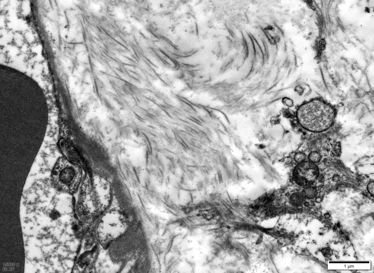 ee2b477fc9f2f61405e45a13327c55d8